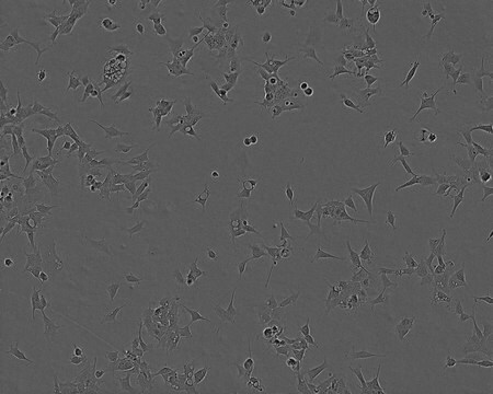 Linia komórkowa 293 NOTE: Both the cell line and DNA from the cell line may be available for this product. Please choose -1VL or VIAL for cells, or -DNA-5UG for DNA, 85120602, human kidney (embryonic), Epithelial