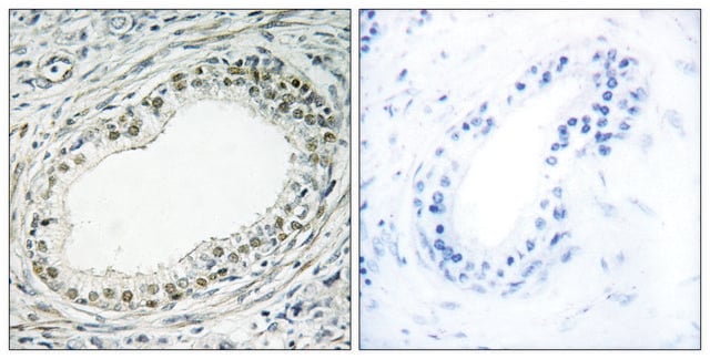 Anti-RPL36 antibody produced in rabbit affinity isolated antibody