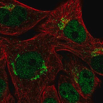 Anti-CYP2U1 antibody produced in rabbit Prestige Antibodies&#174; Powered by Atlas Antibodies, affinity isolated antibody