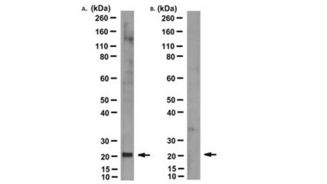 Anti-MT-ATP6 Antibody, clone 1G7-1G2 clone 1G7-1G2, from mouse