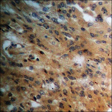 抗-磷酸-PPAR-&#947; (pSer112) 兔抗 affinity isolated antibody