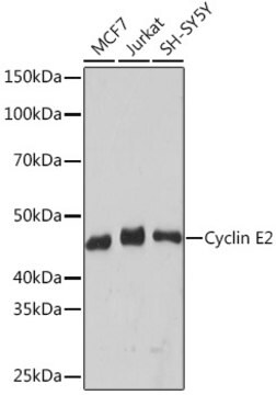 Anti-Cyclin E2 Antibody, clone 0Y7G5, Rabbit Monoclonal