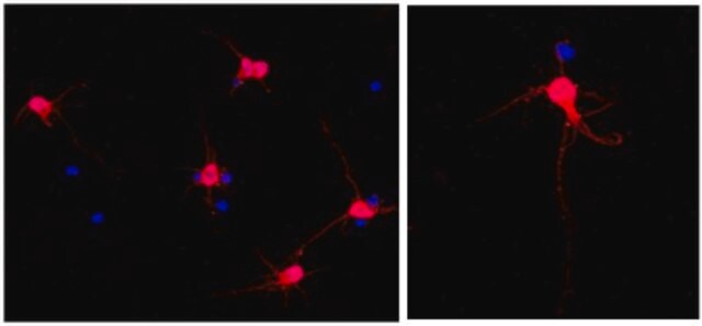 Anti-MAP2 Antibody, clone AP20, Alexa Fluor&#8482; 555 Conjugate clone AP20, from mouse, ALEXA FLUOR&#8482; 555