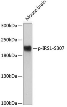 Anti-Phospho-IRS1-S307