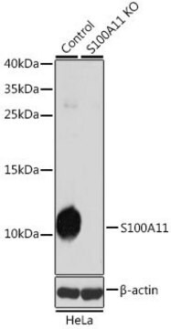 Anti-S100A11 antibody produced in rabbit