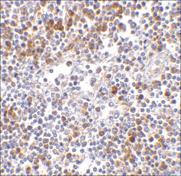 抗MDA5抗体 ウサギ宿主抗体 affinity isolated antibody, buffered aqueous solution