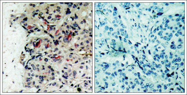 Anti-JAK1 (Ab-1022) antibody produced in rabbit affinity isolated antibody