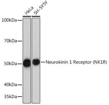 Anti-Neurokinin 1 Receptor (NK1R) Antibody, clone 9T1W2, Rabbit Monoclonal