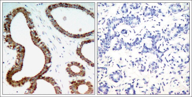 Anti-YWHAZ (Ab-58) antibody produced in rabbit affinity isolated antibody