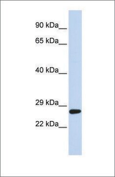 抗SETD4抗体 ウサギ宿主抗体 affinity isolated antibody