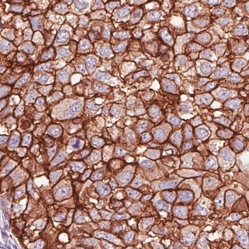 Monoclonal Anti-HER2 antibody produced in mouse Prestige Antibodies&#174; Powered by Atlas Antibodies, clone CL0269, purified immunoglobulin, buffered aqueous glycerol solution