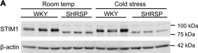 Anti-STIM1 (N-terminal) ~1&#160;mg/mL, affinity isolated antibody, buffered aqueous solution