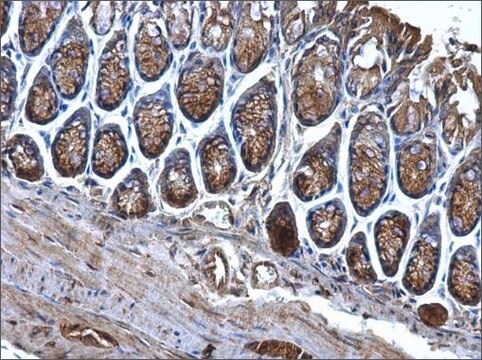 Anti-CD2AP antibody produced in rabbit affinity isolated antibody, buffered aqueous solution