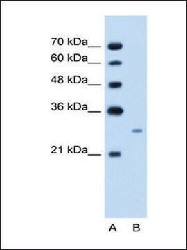 Anti-FST antibody produced in rabbit IgG fraction of antiserum