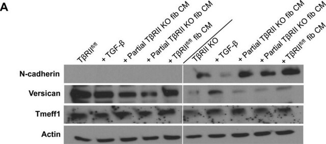 Anticorps anti-versicane, a.a.&nbsp;1360-1439 de versicane de souris Chemicon&#174;, from rabbit