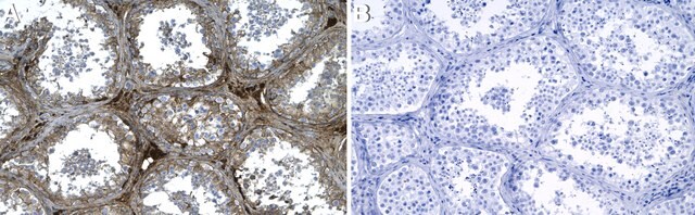 Anti-PRPS1 Antibody, clone 2D21 ZooMAb&#174; Rabbit Monoclonal recombinant, expressed in HEK 293 cells