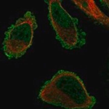 Anti-TMEM101 antibody produced in rabbit Prestige Antibodies&#174; Powered by Atlas Antibodies, affinity isolated antibody, buffered aqueous glycerol solution