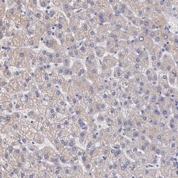 Anti-AMBP antibody produced in rabbit Prestige Antibodies&#174; Powered by Atlas Antibodies, affinity isolated antibody, buffered aqueous glycerol solution