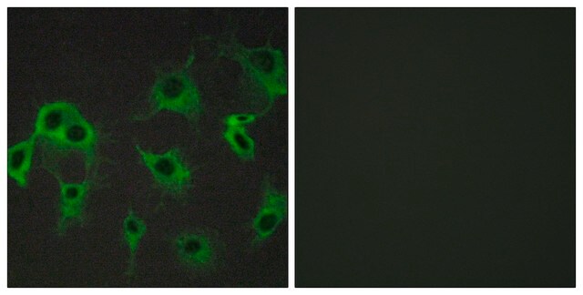 Anti-ADRB2 antibody produced in rabbit affinity isolated antibody