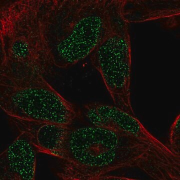 Anti-CTHRC1 antibody produced in rabbit Prestige Antibodies&#174; Powered by Atlas Antibodies, affinity isolated antibody