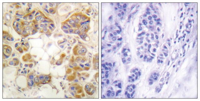 Anti-Collagen I antibody produced in rabbit affinity isolated antibody