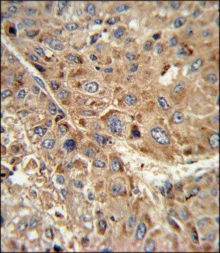 ANTI-GPX1 (C-TERM) antibody produced in rabbit IgG fraction of antiserum, buffered aqueous solution