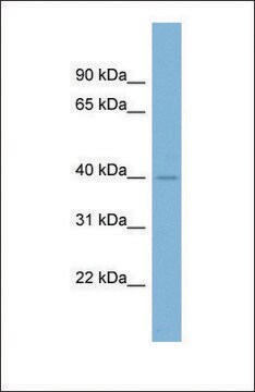 Anti-A4GALT antibody produced in rabbit affinity isolated antibody