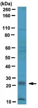 Anti-RGS4 Antibody serum, from rabbit