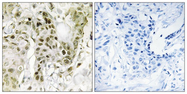 抗BCOR抗体 ウサギ宿主抗体 affinity isolated antibody