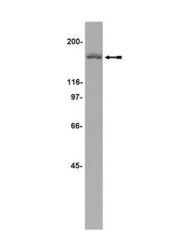 Anti-HDAC5 Antibody Upstate&#174;, from rabbit