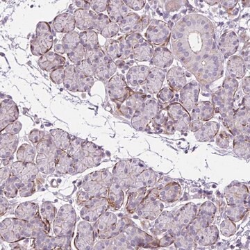 Anti-ZNF197 antibody produced in rabbit Prestige Antibodies&#174; Powered by Atlas Antibodies, affinity isolated antibody, buffered aqueous glycerol solution