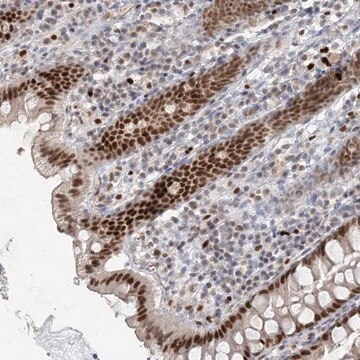 Anti-AK9 antibody produced in rabbit Prestige Antibodies&#174; Powered by Atlas Antibodies, affinity isolated antibody, buffered aqueous glycerol solution