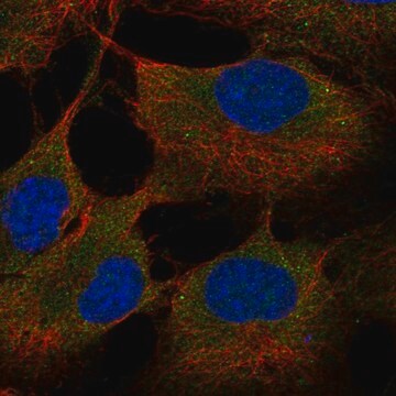 Anti-St6Galnac6 Antibody Produced In Rabbit Prestige Antibodies&#174; Powered by Atlas Antibodies, affinity isolated antibody, buffered aqueous glycerol solution