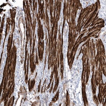 Anti-GTDC1 antibody produced in rabbit Prestige Antibodies&#174; Powered by Atlas Antibodies, affinity isolated antibody, buffered aqueous glycerol solution