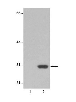 Anticorps anti-néomycine phosphotransférase&nbsp;II Upstate&#174;, from rabbit