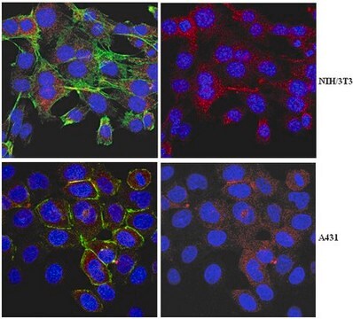 Anti-Myosin-VI Antibody from rabbit, purified by affinity chromatography