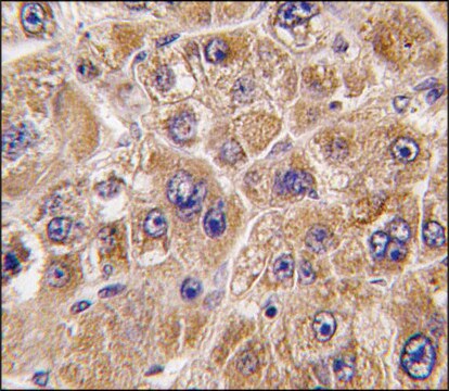 Anti-ALDH5A1 (N-term) antibody produced in rabbit affinity isolated antibody, buffered aqueous solution