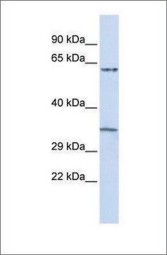 Anti-TRIM8 (ab2) antibody produced in rabbit affinity isolated antibody