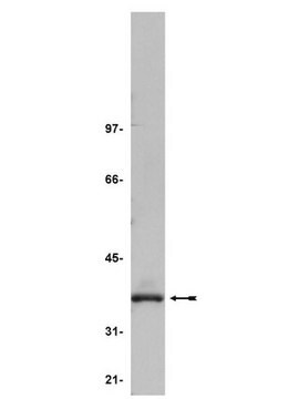 Anti-PP2A Antibody, C subunit, clone 7A6 culture supernatant, clone 7A6, Upstate&#174;