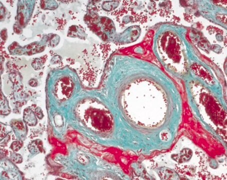 Masson-Goldner染色试剂盒 for the visualization of connective tissue with trichromic staining