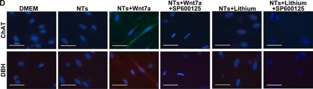 Anti-Choline Acetyltransferase Antibody, clone 1E6 ascites fluid, clone 1E6, Chemicon&#174;