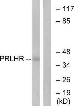 Anti-PRLHR antibody produced in rabbit affinity isolated antibody