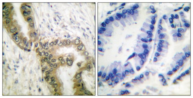 Anti-p53 (Acetyl-Lys386), C-Terminal antibody produced in rabbit affinity isolated antibody