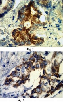 Anti-Nectin-4/PVRL4 Antibody, clone N4.61 clone N4.61.2, from mouse