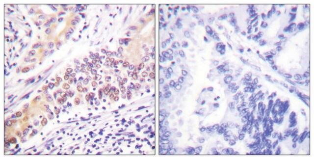 Anti-TOP2B antibody produced in rabbit affinity isolated antibody