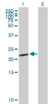 Anti-CGB5 antibody produced in mouse purified immunoglobulin, buffered aqueous solution