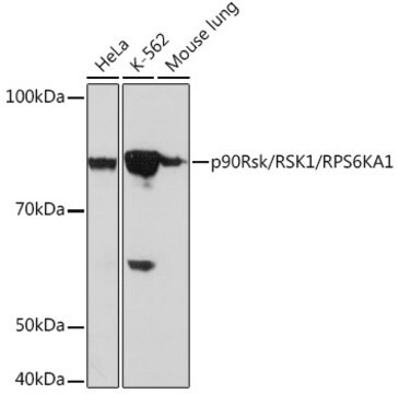 Anti-p90Rsk/RSK1/RPS6KA1 Antibody, clone 9D9U7, Rabbit Monoclonal