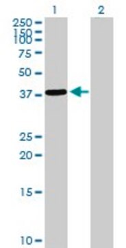 抗EPM2A抗体 ウサギ宿主抗体 purified immunoglobulin, buffered aqueous solution