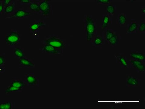 Anti-SIRT7 antibody produced in rabbit purified immunoglobulin, buffered aqueous solution