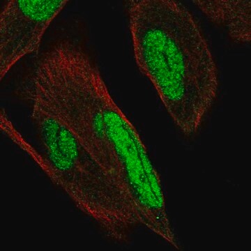 Anti-PKNOX1 antibody produced in rabbit Prestige Antibodies&#174; Powered by Atlas Antibodies, affinity isolated antibody